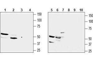 Western blot analysis of rat kidney membrane (lanes 1 and 3), mouse kidney lysate (lanes 2 and 4), mouse TK-1 T-cell lymphoma (lanes 5 and 8), mouse J774 macrophage cell (lanes 6 and 9) and human Jurkat acute T cell leukemia (lanes 7 and 10) lysates: - 1,2,5,6,7. (SUCNR1 antibody  (3rd Extracellular Loop))