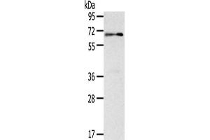 Gel: 8 % SDS-PAGE,Lysate: 40 μg,Primary antibody: ABIN7131054(SIGLEC12 Antibody) at dilution 1/500 dilution,Secondary antibody: Goat anti rabbit IgG at 1/8000 dilution,Exposure time: 1 minute (SIGLEC12 antibody)
