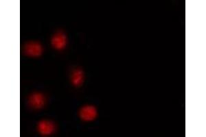 ABIN6267249 staining HT29 by IF/ICC. (SNAIL antibody  (pSer246))