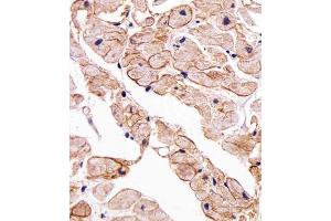 Immunohistochemical analysis of paraffin-embedded H. (SGCG antibody  (AA 145-172))