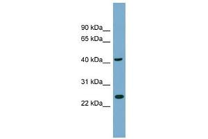 FLJ25439 antibody used at 1 ug/ml to detect target protein. (TTC23L antibody  (N-Term))