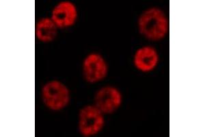 ABIN6267660 staining HeLa by IF/ICC. (SMAD1 antibody  (pSer465))