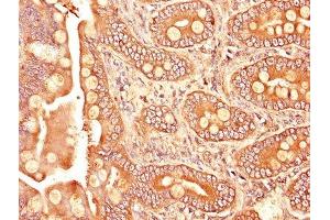 IHC image of ABIN7171957 diluted at 1:1200 and staining in paraffin-embedded human small intestine tissue performed on a Leica BondTM system. (TGFBR1 antibody  (AA 157-244))