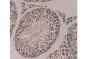 Used in DAB staining on fromalin fixed paraffin- embedded Kidney tissue (Aurora Kinase C antibody  (AA 5-237))