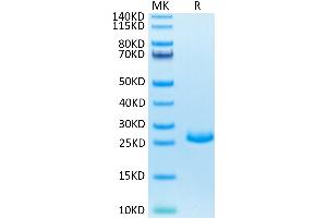 Mouse FGF21 on Tris-Bis PAGE under reduced condition. (FGF21 Protein (AA 29-210) (His tag))
