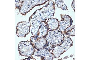 Immunohistochemistry of paraffin-embedded human placenta using P4HB Rabbit mAb (ABIN7269560) at dilution of 1:100 (40x lens). (P4HB antibody)