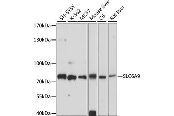 GLYT1 抗体  (AA 1-110)