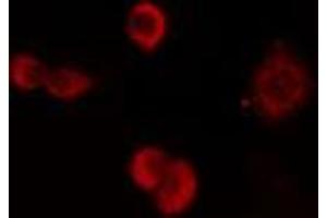 ABIN6274180 staining HuvEc cells by IF/ICC. (ZNF24 antibody  (Internal Region))