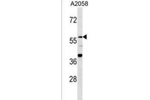 ZN Antibody (N-term) (ABIN1539362 and ABIN2849856) western blot analysis in  cell line lysates (35 μg/lane).