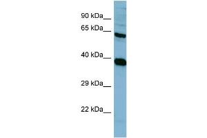 Western Blotting (WB) image for anti-Protein Phosphatase 2, Regulatory Subunit A, alpha (PPP2R1A) (N-Term) antibody (ABIN2787389) (PPP2R1A antibody  (N-Term))
