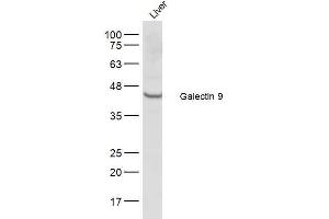 Galectin 9 antibody  (AA 51-150)