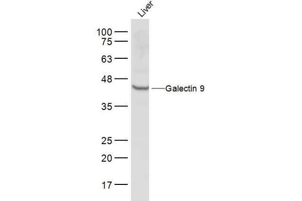 Galectin 9 antibody  (AA 51-150)