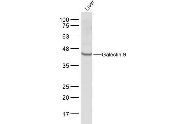 Galectin 9 anticorps  (AA 51-150)