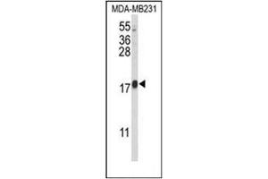 Western blot analysis of CBY1 Antibody (C-term) in MDA-MB231 cell line lysates (35ug/lane). (CBY1/PGEA1 antibody  (C-Term))