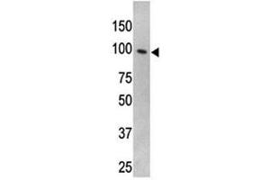 TLR5 antibody used in western blot to detect TLR5 in HL-60 cell lysate (TLR5 antibody  (AA 71-102))