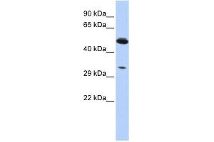 PIK3IP1 antibody used at 1 ug/ml to detect target protein. (PIK3IP1 antibody  (Middle Region))