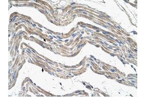 IDH3A antibody was used for immunohistochemistry at a concentration of 4-8 ug/ml to stain Skeletal muscle cells (arrows) in Human Muscle.