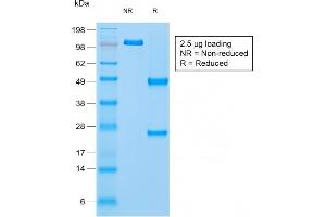 SDS-PAGE Analysis Purified Napsin A Rabbit Recombinant Monoclonal Antibody (NAPSA/1865R). (Recombinant NAPSA antibody  (AA 189-299))