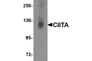 Western Blotting (WB) image for anti-Class II, Major Histocompatibility Complex, Transactivator (CIITA) (N-Term) antibody (ABIN1031320)