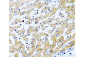 Immunohistochemistry of paraffin-embedded Human liver using CCL21 Polyclonal Antibody at dilution of 1:100 (40x lens). (CCL21 antibody)