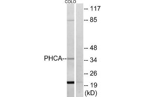 Western blot analysis of extracts from COLO cells, using PHCA antibody. (ACER3 antibody  (Internal Region))