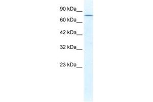 Western Blotting (WB) image for anti-DEAD (Asp-Glu-Ala-Asp) Box Polypeptide 23 (DDX23) antibody (ABIN2461345) (DDX23 antibody)