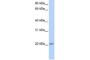 TCEAL2 antibody used at 0.