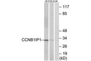 Western blot analysis of extracts from Jurkat/COLO cells, using CCNB1IP1 Antibody. (CCNB1IP1 antibody  (AA 201-250))