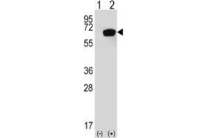 Western Blotting (WB) image for anti-Heat Shock 70kDa Protein 1A (HSPA1A) antibody (ABIN3003299) (HSP70 1A antibody)