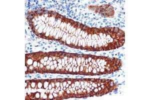 Immunohistochemistry of paraffin-embedded human appendix using Galectin 4/LG Rabbit mAb (ABIN1679347, ABIN3017979, ABIN3017980 and ABIN7101554) at dilution of 1:100 (40x lens). (GAL4 antibody)
