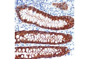 Immunohistochemistry of paraffin-embedded human appendix using Galectin 4/LG Rabbit mAb (ABIN1679347, ABIN3017979, ABIN3017980 and ABIN7101554) at dilution of 1:100 (40x lens).