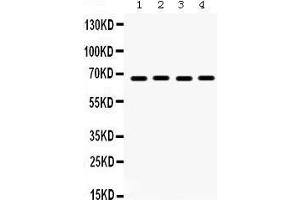 Western Blotting (WB) image for anti-Ets Variant 4 (ETV4) (AA 1-41), (N-Term) antibody (ABIN3042379) (ETV4 antibody  (N-Term))