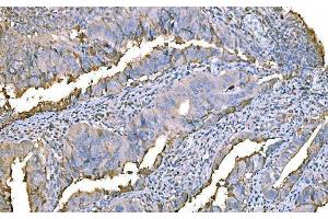 IHC analysis of Prothrombin using anti-Prothrombin antibody (ABIN7602705). (Prothrombin Fragment 2 (AA 97-124) antibody)