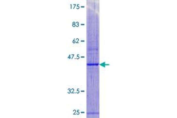 MPV17 Protein (AA 1-176) (GST tag)