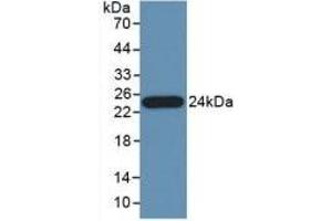 Detection of Recombinant PTa, Human using Polyclonal Antibody to Pancreas Specific Transcription Factor 1a (PTF1a) (PTF1A antibody  (AA 177-328))