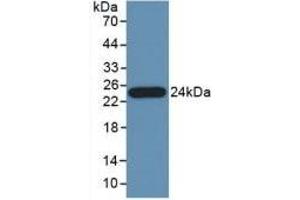 Detection of Recombinant PTa, Human using Polyclonal Antibody to Pancreas Specific Transcription Factor 1a (PTF1a)