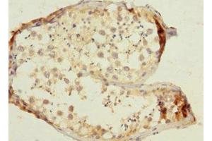 Immunohistochemistry of paraffin-embedded human testis tissue using ABIN7171931 at dilution of 1:100 (TTC32 antibody  (AA 1-151))