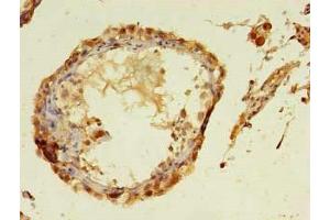Immunohistochemistry of paraffin-embedded human testis tissue using ABIN7172949 at dilution of 1:100 (TMCO5A antibody  (AA 10-192))