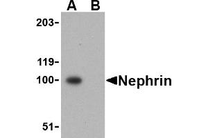 Western blot analysis of Nephrin in mouse kidney tissue lysate with Nephrin antibody at 1 µg/mL in the (A) absence and (B) presence of blocking peptide.