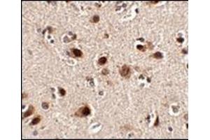 Immunohistochemistry of Slitrk4 in human brain tissue with this product at 2. (SLITRK5 antibody  (Center))