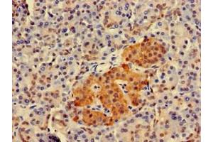 Immunohistochemistry of paraffin-embedded human pancreatic tissue using ABIN7173936 at dilution of 1:100 (TWF1 antibody  (AA 199-252))