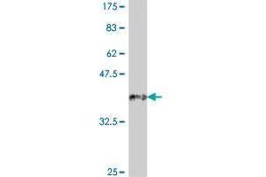 Western Blot detection against Immunogen (37. (SFRP4 antibody  (AA 211-312))