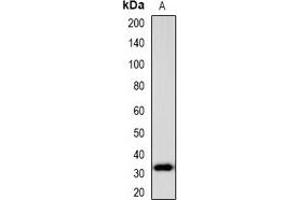 Western blot analysis of PENK expression in Jurkat (A) whole cell lysates. (Enkephalin antibody)