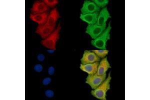 ABIN7094925 and ABIN7098981 staining Hela cells by IF/ICC. (Calpastatin antibody)