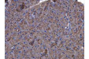Immunohistochemistry (IHC) image for anti-Coagulation Factor XIII, A1 Polypeptide (F13A1) (N-Term) antibody (ABIN2856753)