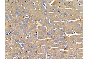 ABIN6258654 and ABIN6275038 at 1/100 staining rat brain tissue by IHC-P. (CNTN2 antibody  (N-Term))