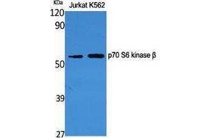 Western Blot (WB) analysis of specific cells using p70 S6 kinase beta Polyclonal Antibody. (RPS6KB2 antibody  (Tyr1016))