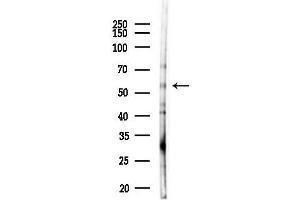 anti-Aldehyde Dehydrogenase 7 Family, Member A1 (ALDH7A1) (C-Term) antibody