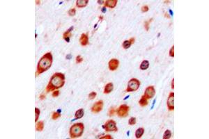 Immunohistochemical analysis of CRHR2 staining in human brain formalin fixed paraffin embedded tissue section. (CRHR2 antibody  (Center))