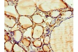 Immunohistochemistry of paraffin-embedded human thyroid tissue using ABIN7169127 at dilution of 1:100 (PAK2 antibody  (AA 1-212))